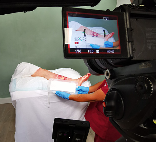 Production video secteur medical